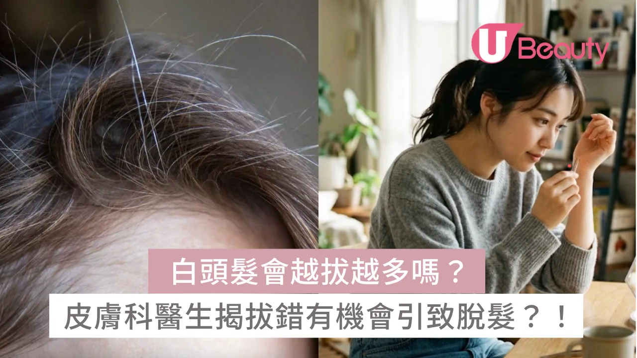 白頭髮會越拔越多嗎？皮膚科醫生揭拔錯有機會引致脫髮？！