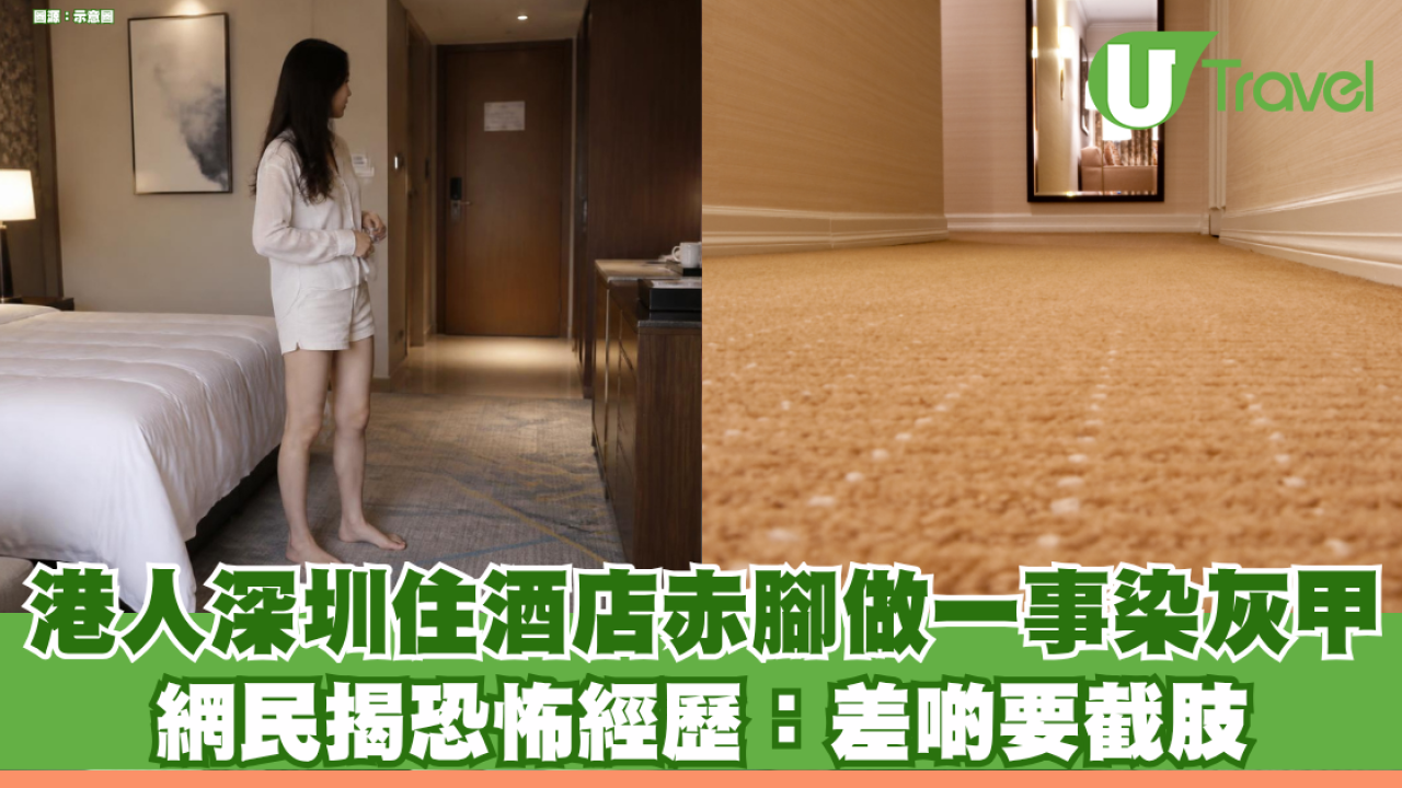 港人入住深圳酒店赤腳行地毯 一星期後染灰甲死皮增厚！網民揭恐怖經歷：差啲要截肢