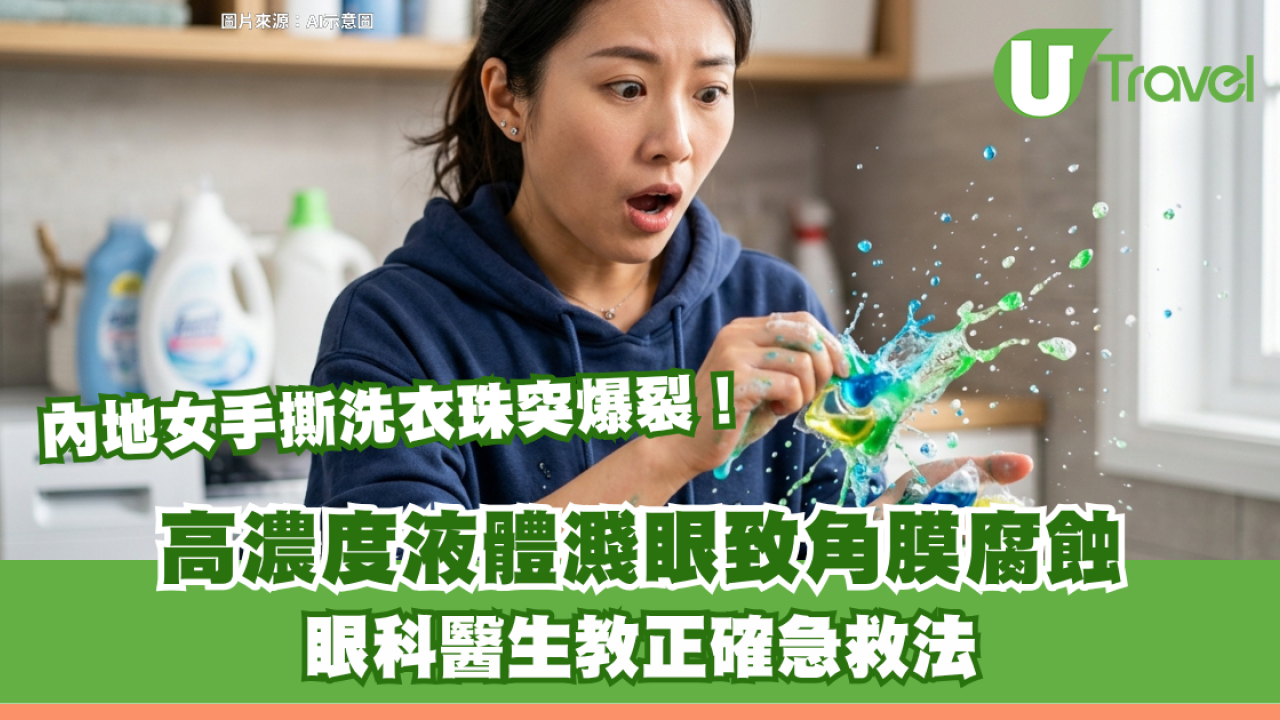 內地女手撕洗衣珠突爆裂！高濃度液體濺眼致角膜腐蝕 眼科醫生教正確急救法