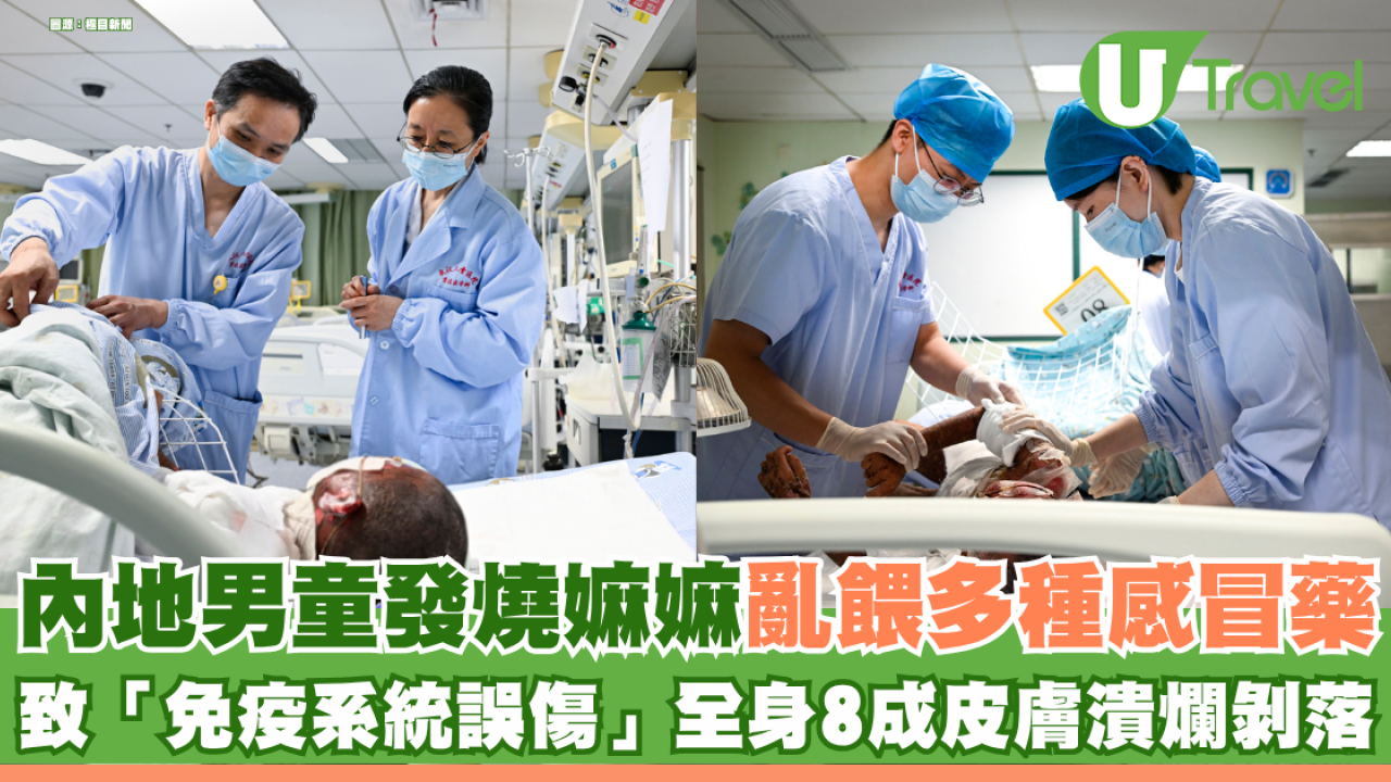 Photo: U Travel 10-Year-Old Boy Suffers Severe TEN with 80% Skin Peeling After Medication Reaction