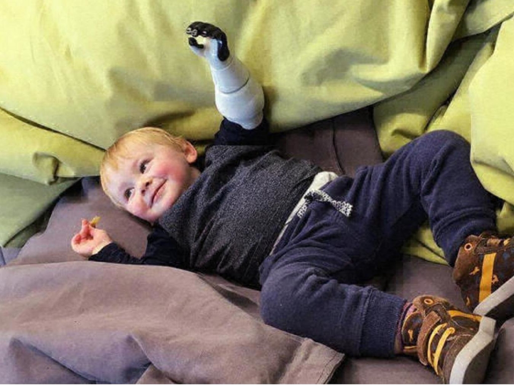 【有洋蔥】好爸爸為幼子自學製義肢！開公司研發嬰幼兒義肢