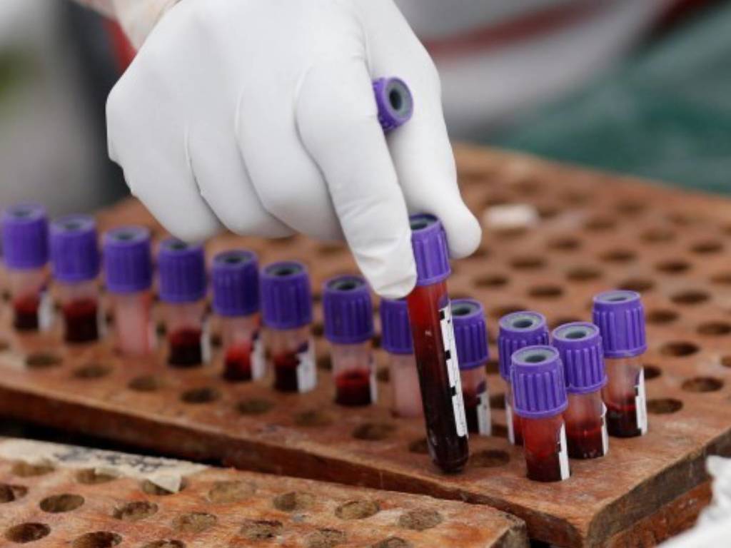 中國現「新超級惡菌」抗生素零效用？或引發敗血症及致死膿毒病