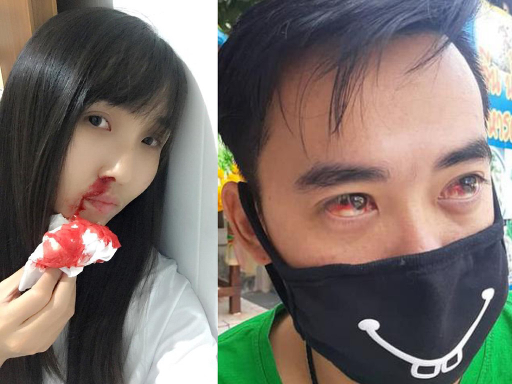 新年遊泰國記得帶口罩！毒霧侵襲居民致流鼻血？