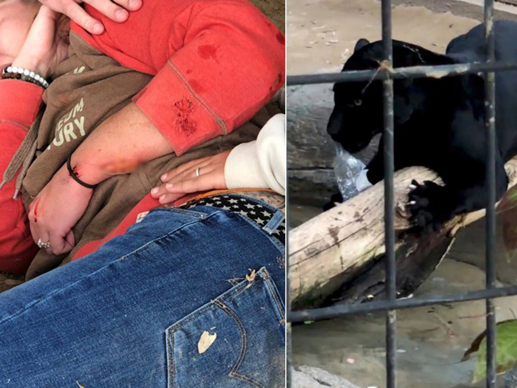 【睇片慎入】女子越欄與美洲豹 selfie 自拍遭抓傷 動物園拒賜豹安樂死：不是豹的錯