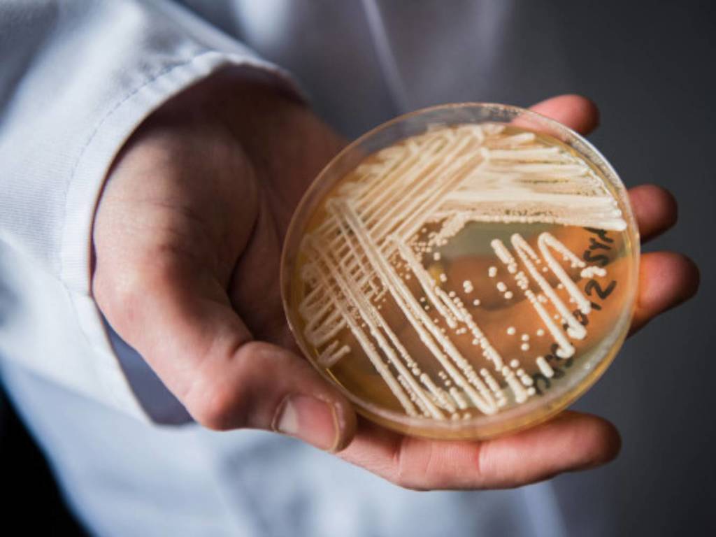 超級惡菌「耳念珠菌」極頑強威脅全球！一半病人 90 天內死亡