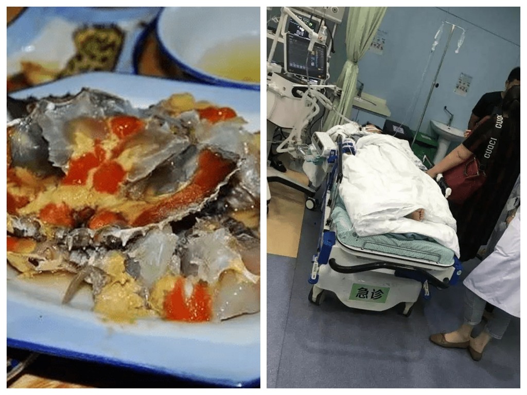 生食醃蟹感染副溶血性弧菌  內地女嚴重感染致器官惡化險死