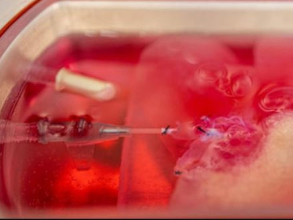 科學家成功仿製迷你版人類肝臟   有望解決器官移植供不應求問題
