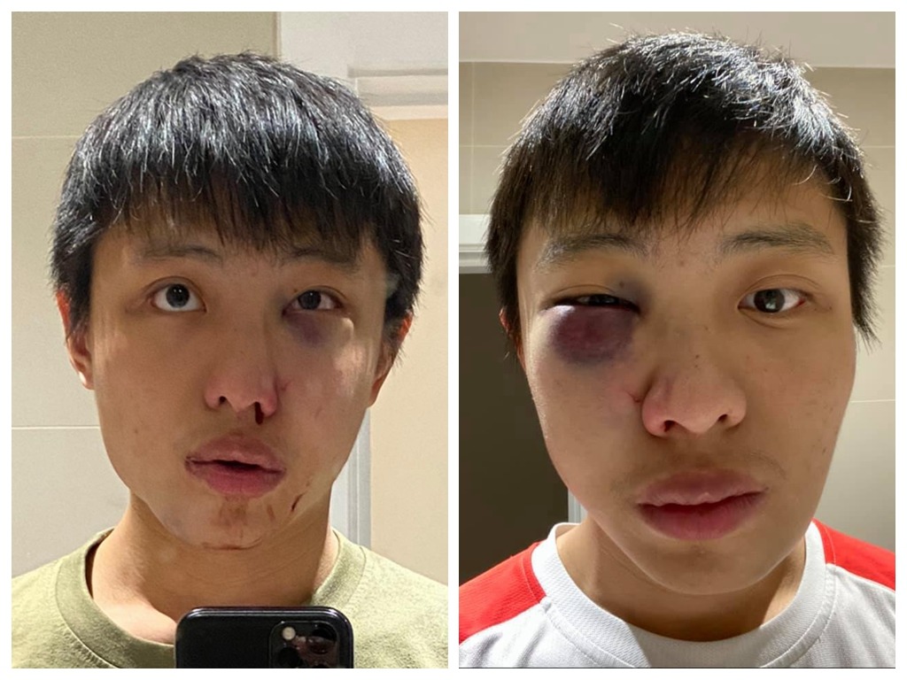 新加坡少年倫敦被圍毆  兇徒吼「你的病毒不要帶進我的國家」