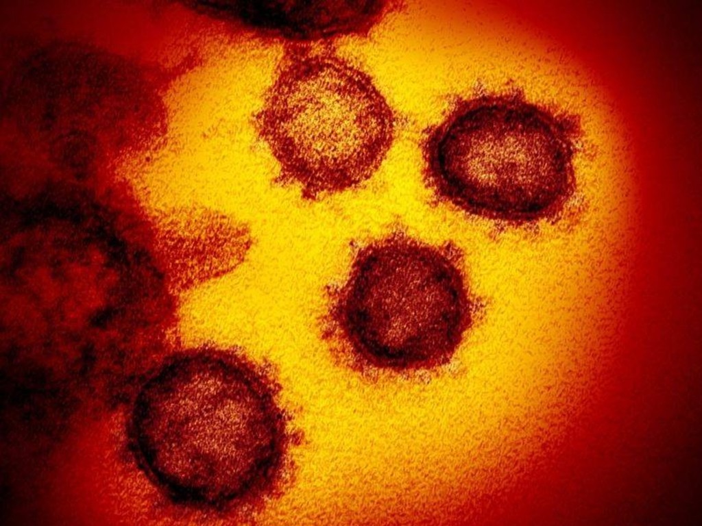 【新冠肺炎】澳洲研究發現治寄生蟲藥可殺新冠病毒  最快 1 個月內作人體試驗