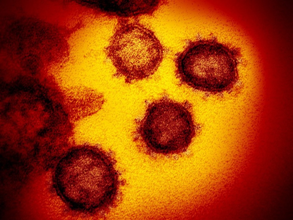 法國研究指 92℃ 高溫才可徹底殺死新冠肺炎病毒
