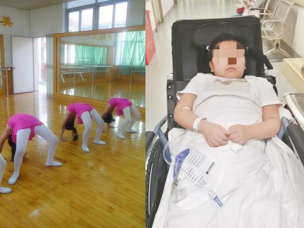 8 歲女學跳舞做拱橋跌傷後導師迫令練習  終致胸椎脊髓損傷下半身癱瘓