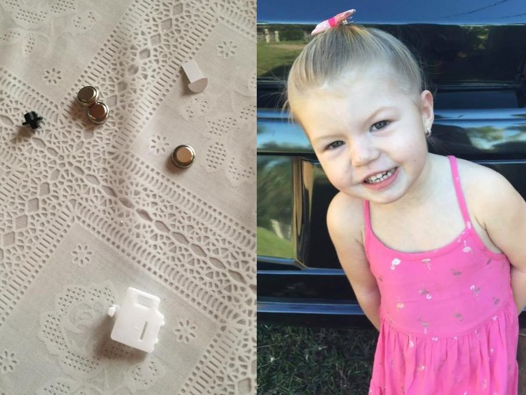 【家長注意】3 歲女童誤吞鈕扣電池  燒穿食道三周後死亡