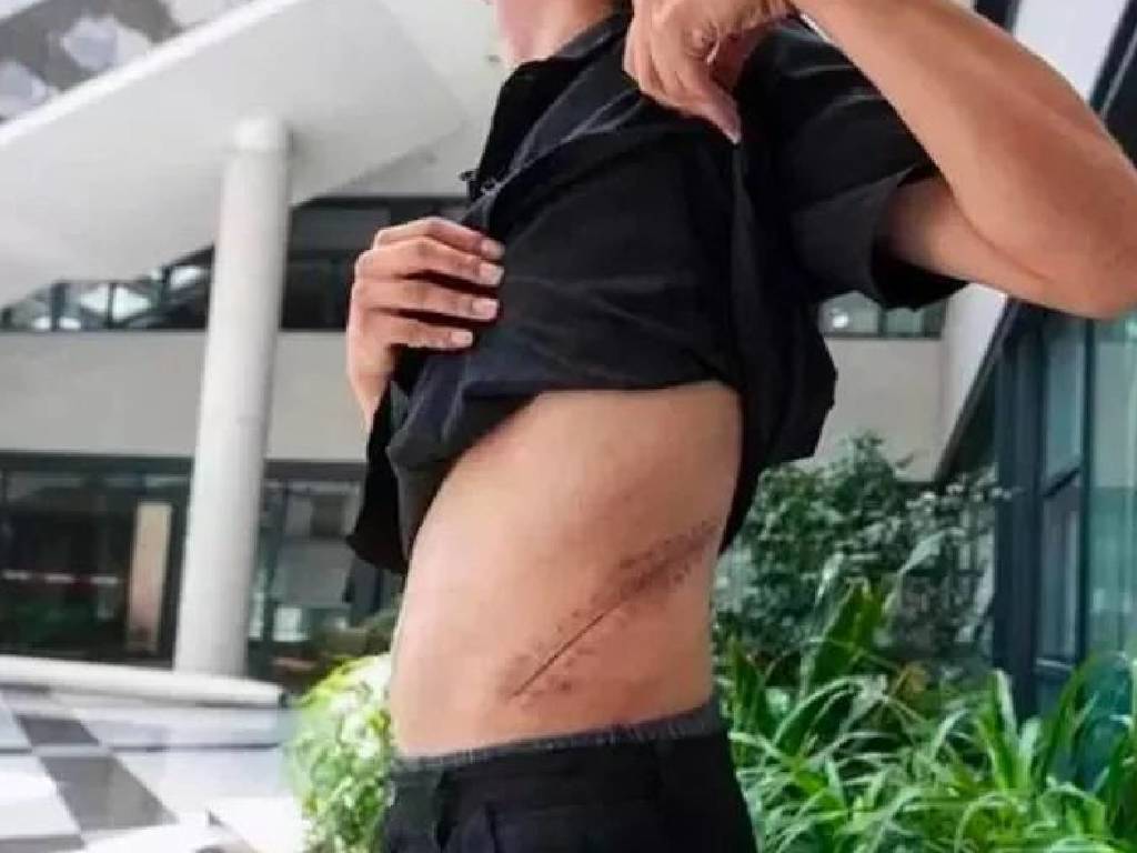 內地男 10 年前賣腎買 iPhone  現已不能自理或需換腎