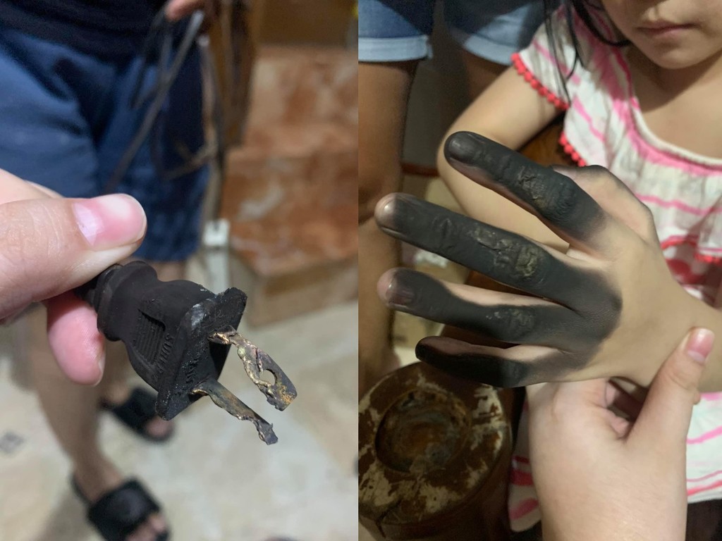 【家居安全】插拖板時突漏電爆炸  7 歲童手指燒黑手掌起泡