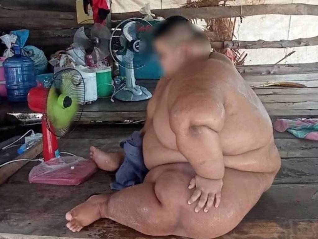 13 歲自閉童重達 440 磅被迫整天全裸！癡肥背後身世悲慘