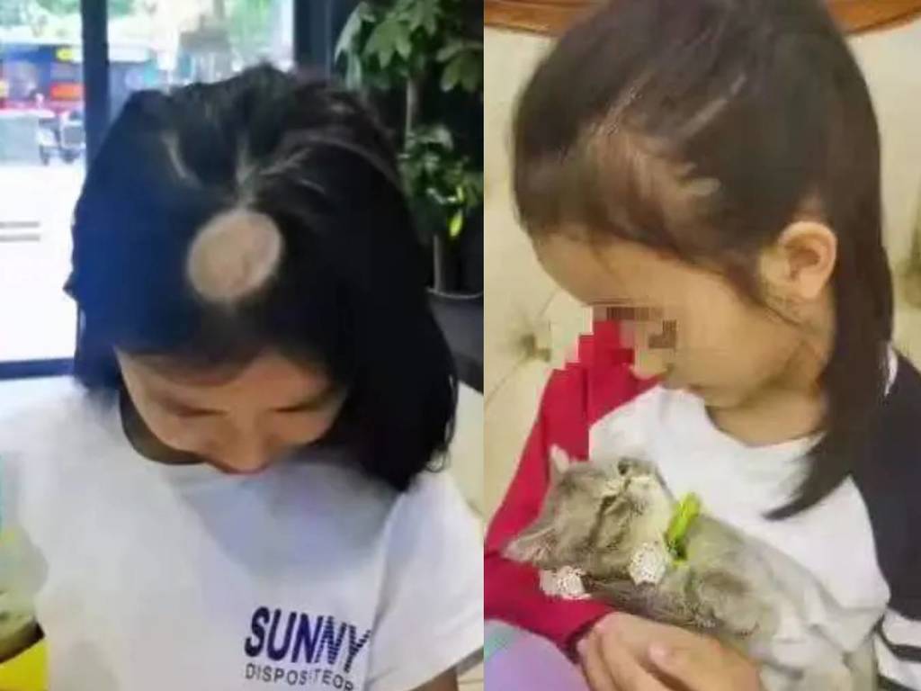 小女孩養貓竟養到禿頭？ 真菌感染致頭癬需剃髮治療