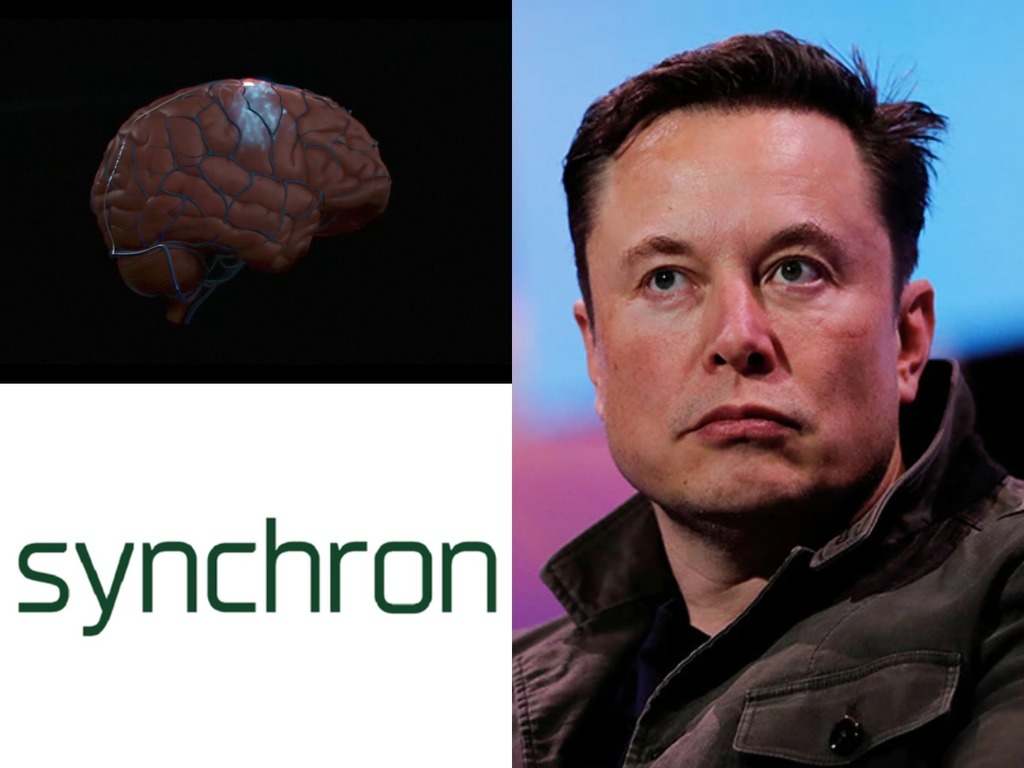 傳 Elon Musk 洽商投資 美國腦晶片公司 Synchron