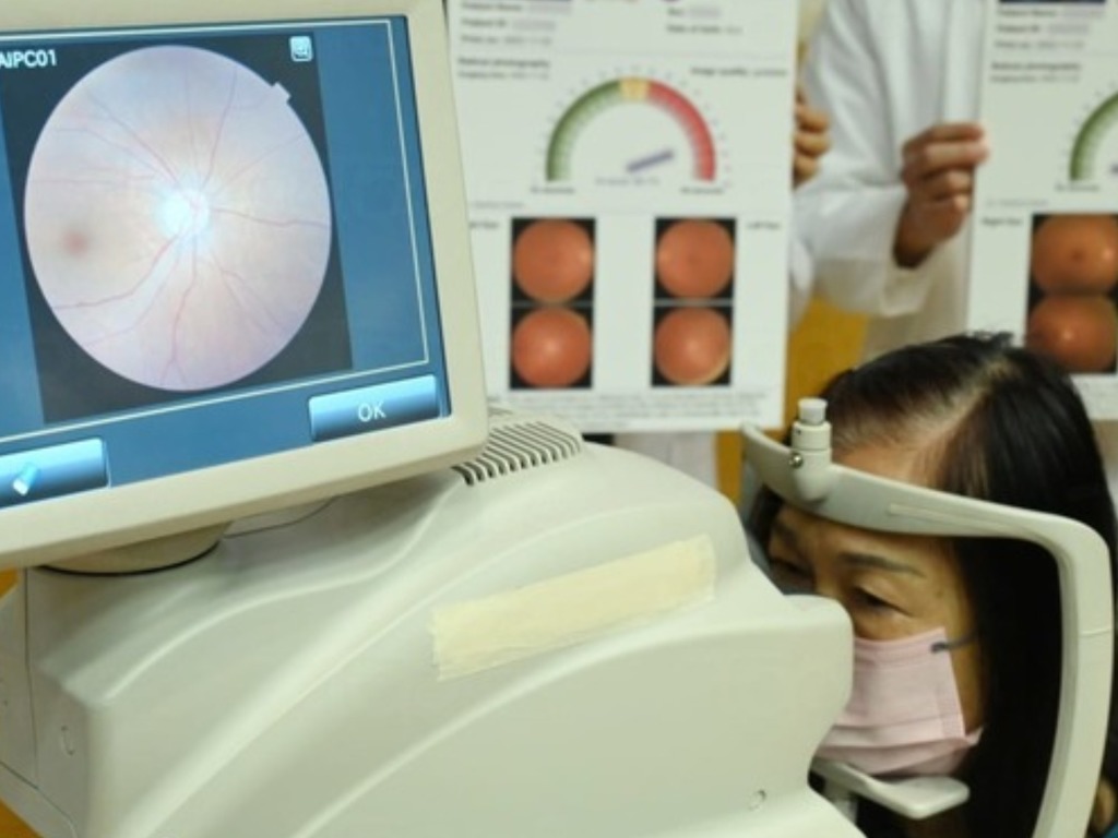 中大智能系統成功以「眼底相」測阿茲海默症 準確度超過 8 成