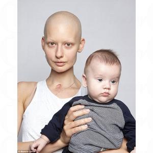 最勇名模媽媽：患癌症仍生產 失去下巴也不放棄愛