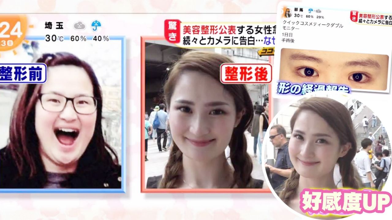 整容唔怕認？日本節目街訪公開 女生自爆整容的5個理由！