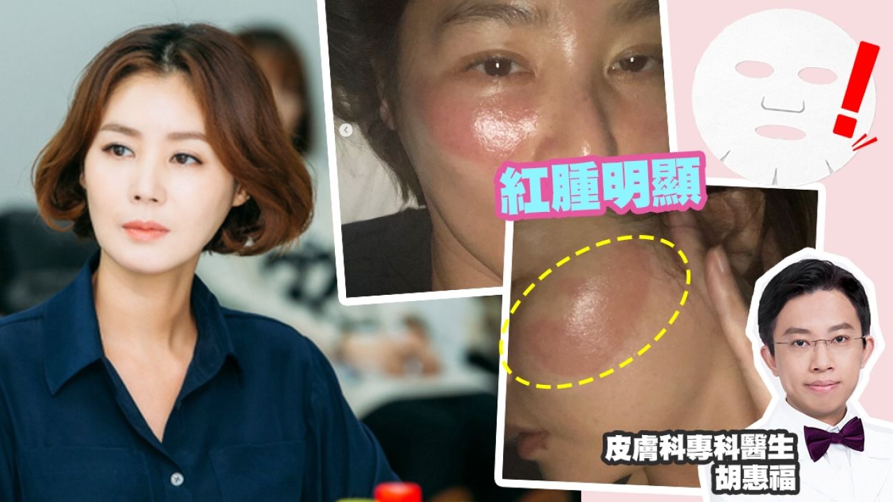 【敷面膜4大建議】韓女星敷眼膜5小時 致皮膚紅腫險毀容