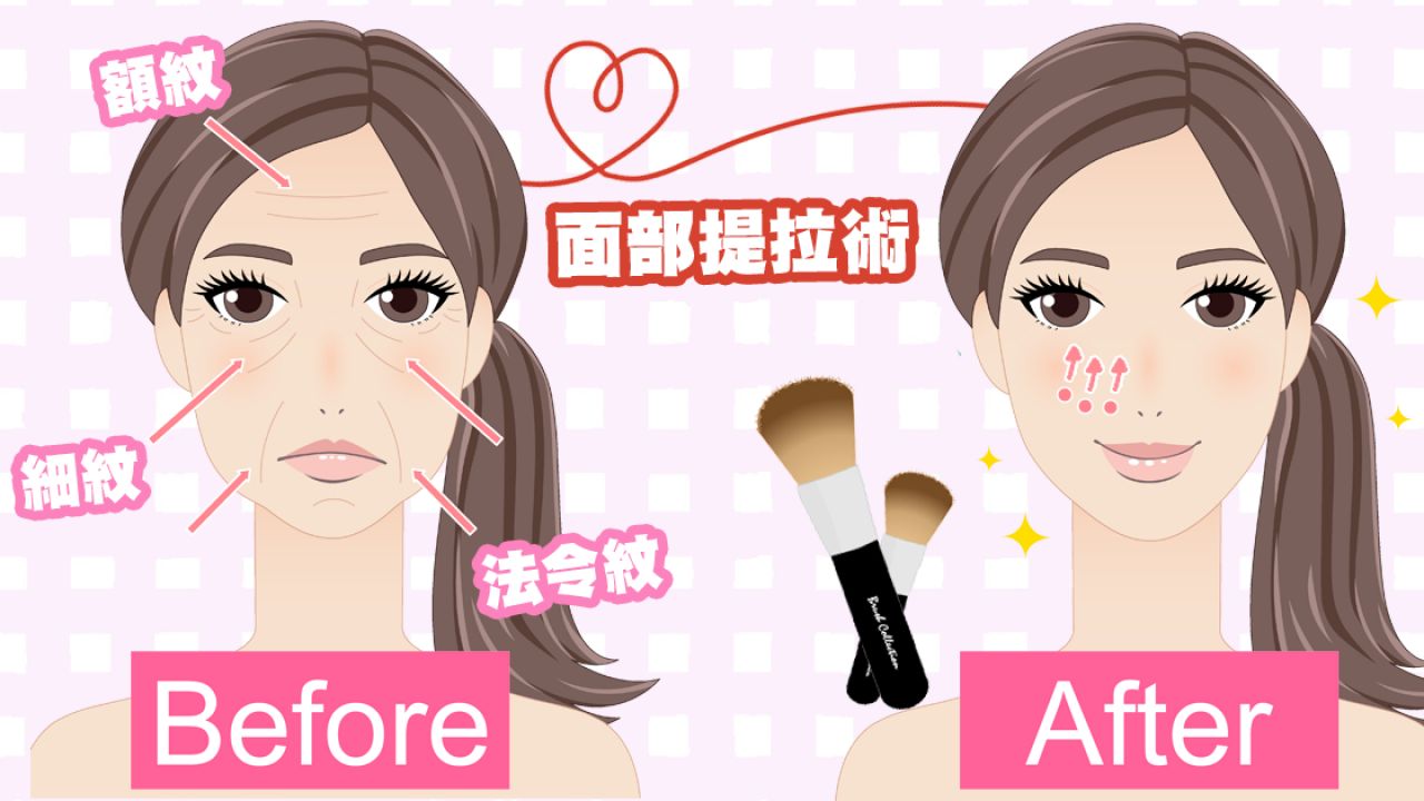 25+女生必看！每天1分鐘改善法令紋！日本節目示範「面部提拉術」！