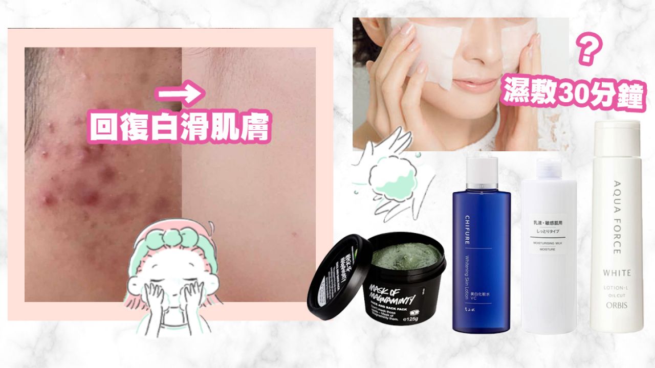 日本女生分享半年治好爛面暗瘡肌！10款護膚品推薦！這2大成分是關鍵！