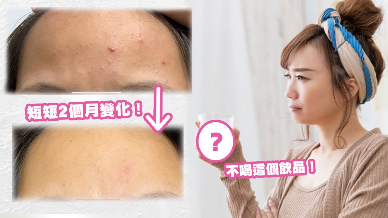 台灣女生分享「去粉刺保養記」！2個月改善粉刺問題！從飲食習慣、護膚品入手！