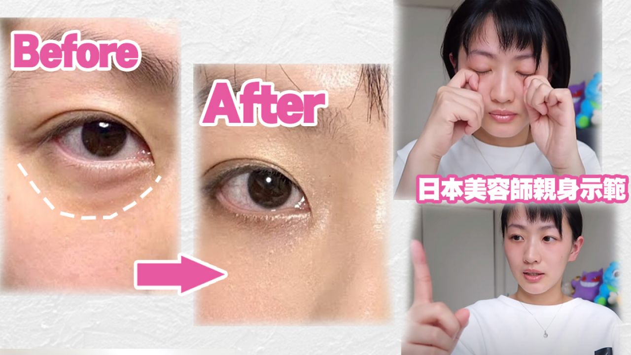 日本大熱眼部按摩改善「眼袋/淚溝」！ 每天8分鐘！輕鬆告別憔悴顯老顏！