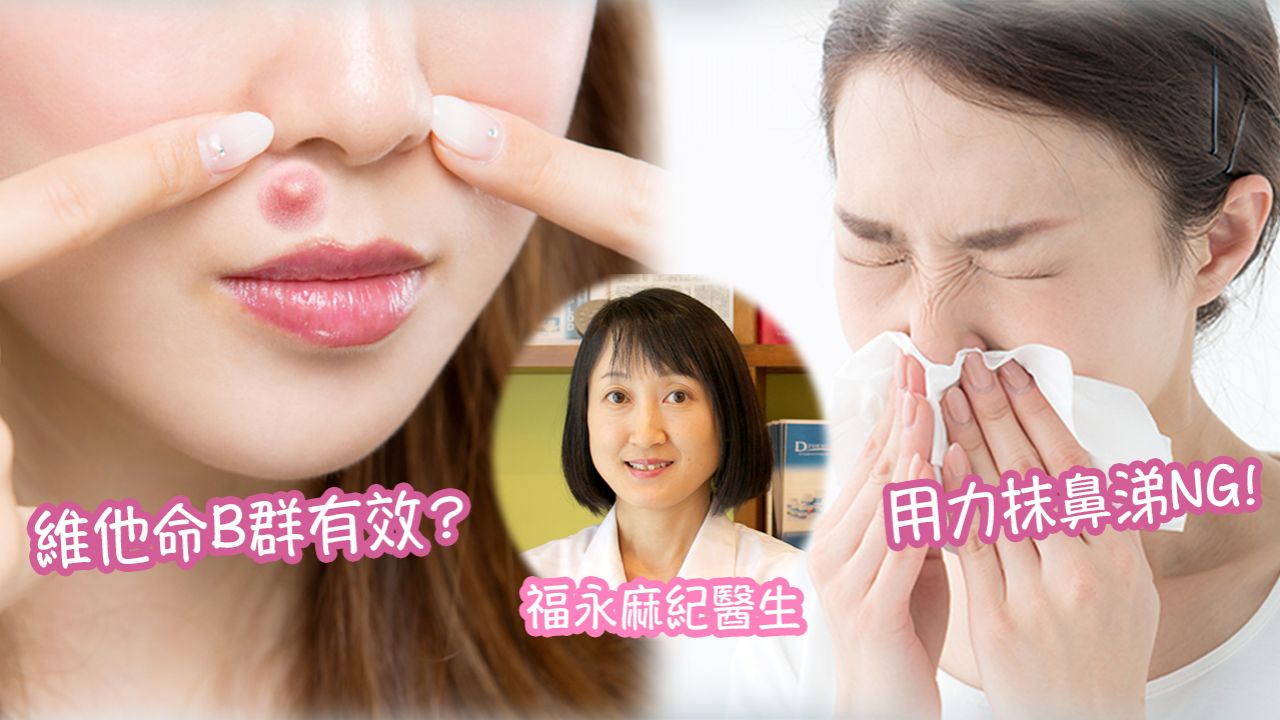 日本皮膚科醫生分析暗瘡成因！7大TIPS告別鼻下惱人痘痘暗粒！吃這些食物可以預防「石頭瘡」！