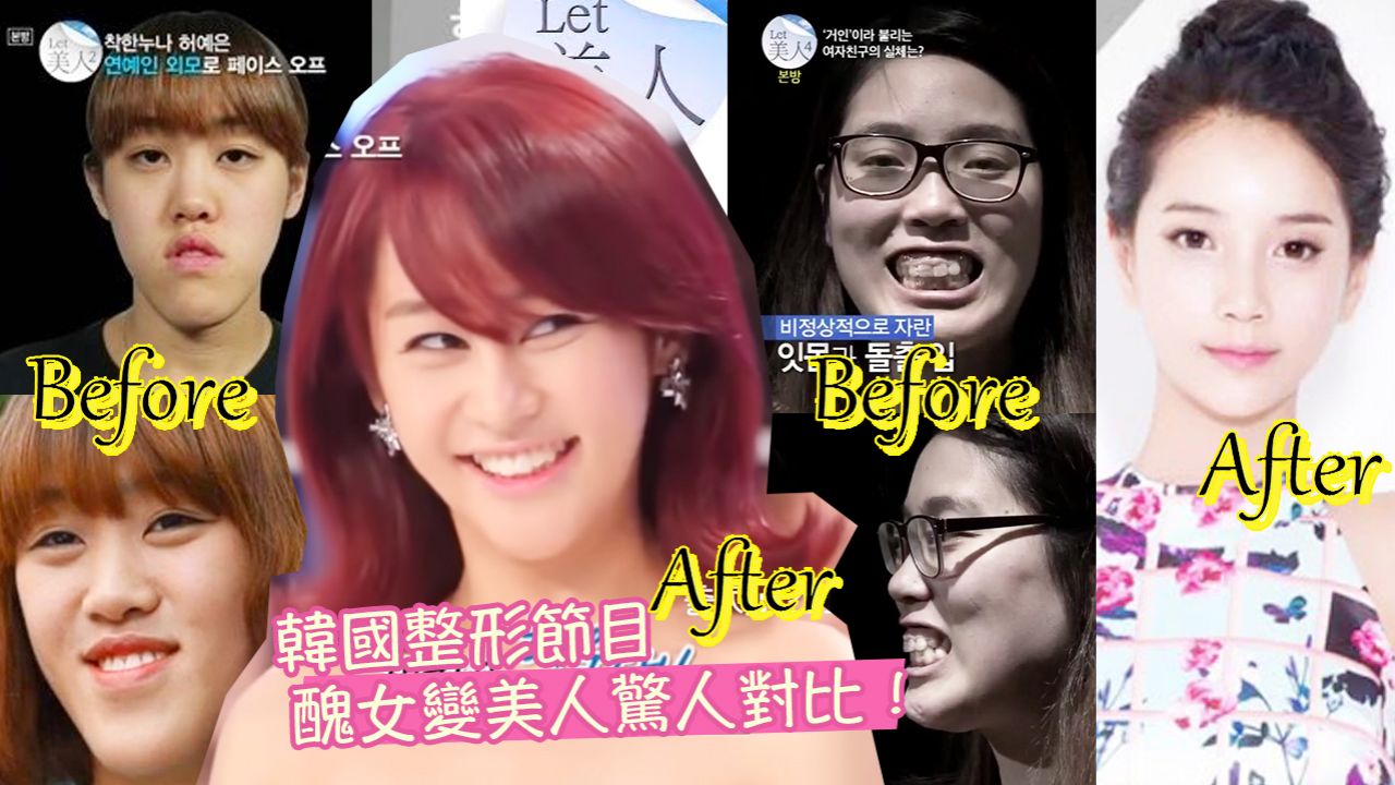 韓國整形節目《Let美人》3大最成功案例！醜女變美女逆轉人生！就像中彩票一樣！