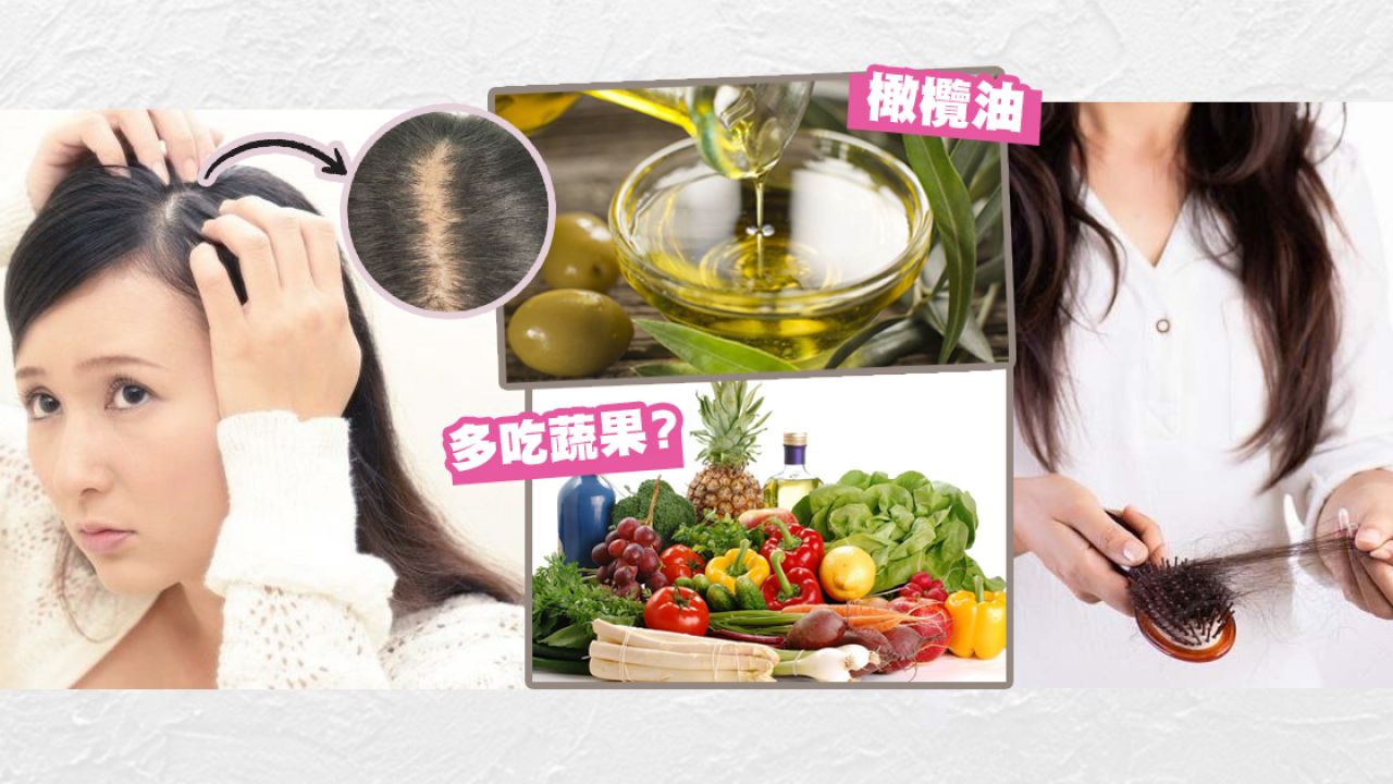 台灣髮型師分享8個防掉髮小貼士！補充蛋白質/維A！附飲食建議！