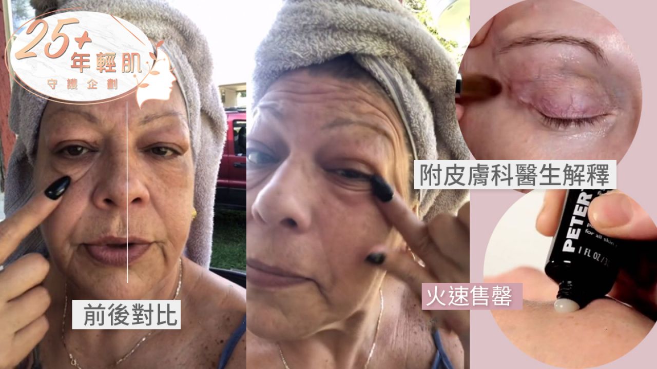 25+年輕肌｜外國54歲女士實測「神奇去紋眼霜」！眼袋/眼紋消失不見！約港幣3百有找！