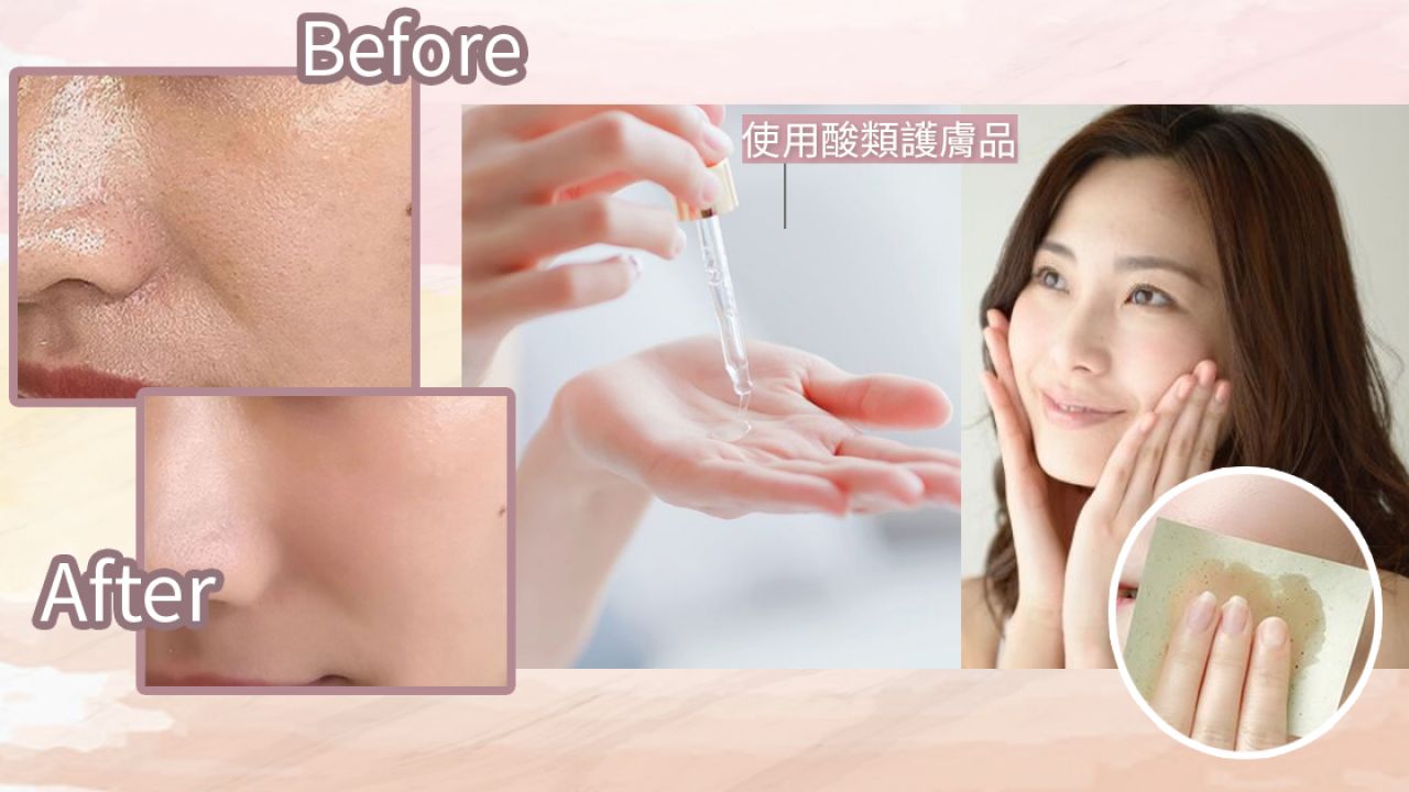 日本美容師分享3招告別滿臉油光！不能過度洗臉？油性肌女生必看！