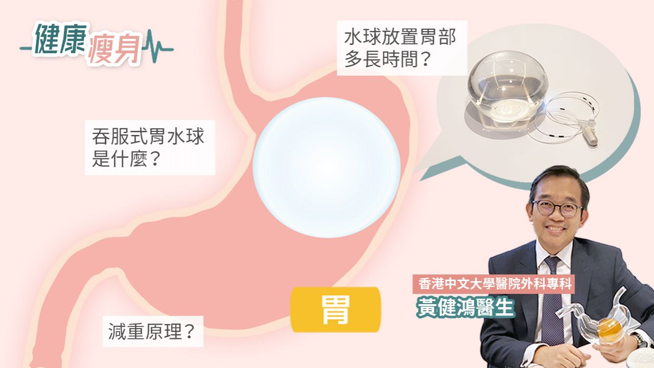【健康瘦身】全新「吞服式胃水球」減重方法！無需手術有效減重10-15%！低風險技術引入香港