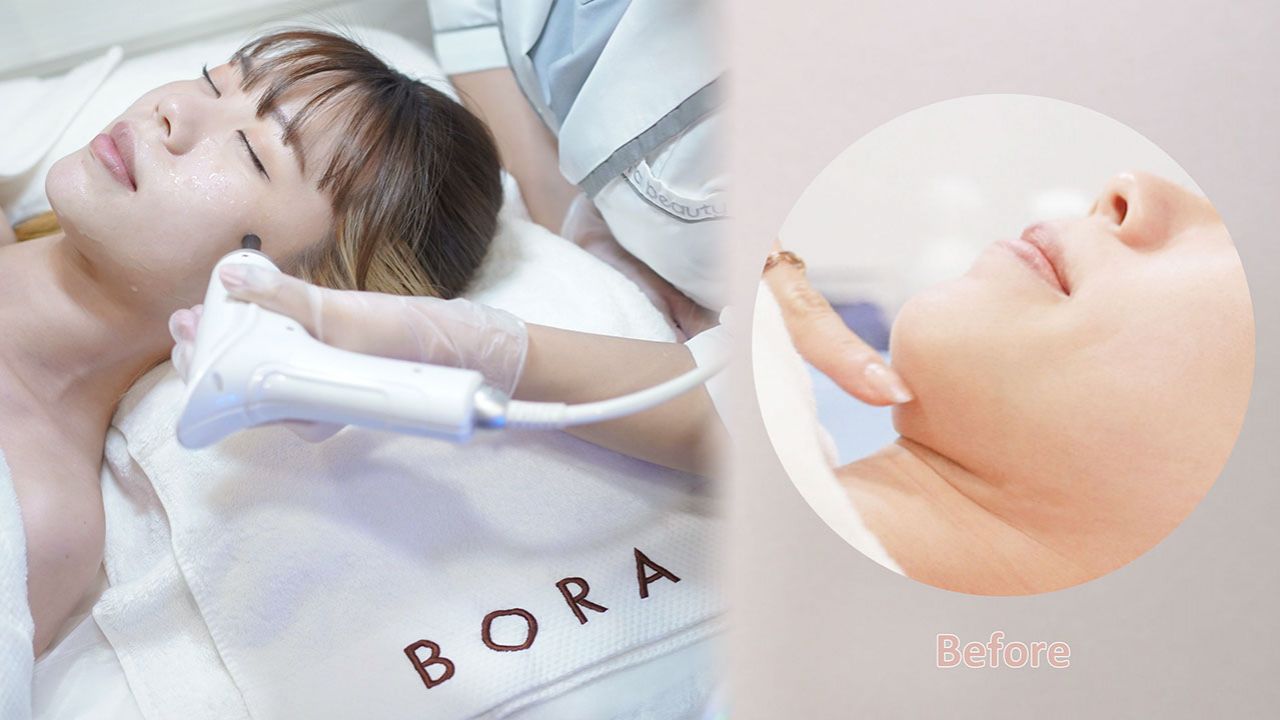 【Bora Beauty兩大療程推薦】Vzet一次瘦面+Bellasonic雙聲頻導入！深層輪廓提拉/解決口罩肌、暗粒