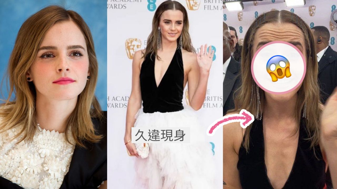 31歲Emma Watson零P圖近照曝光！被指顏值崩壞！顯老皺紋急增嚇壞網友！