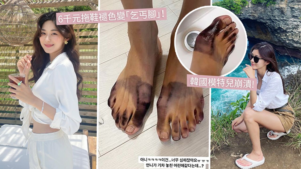 韓女模買$6000名牌拖鞋嚴重掉色！落雨後「雙腳染黑」洗不掉！客服1句回覆令人無語！