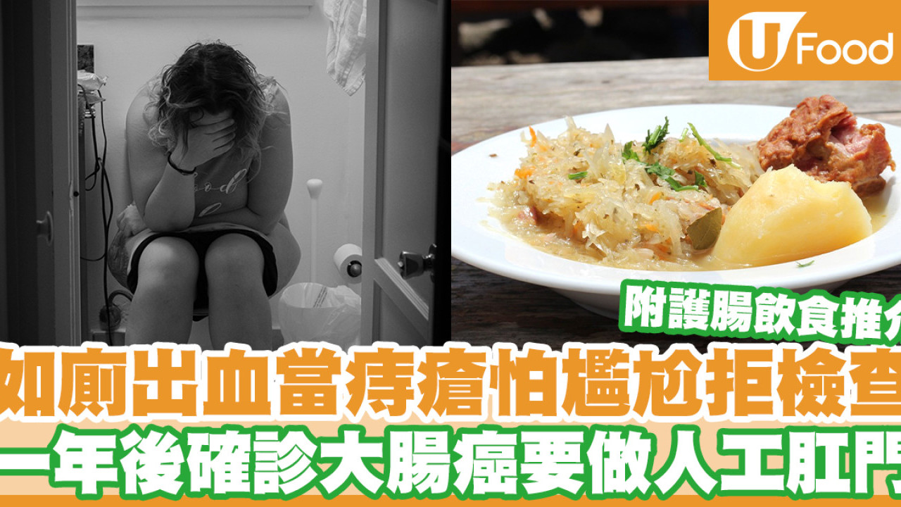 怕醜變癌！如廁出血誤當痔瘡拒檢查 一年後確診大腸癌需做人工肛門