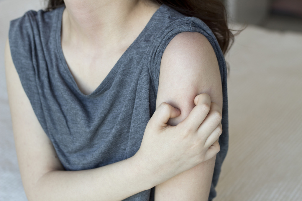 2大對抗濕疹食療 清熱解毒／止癢止痛