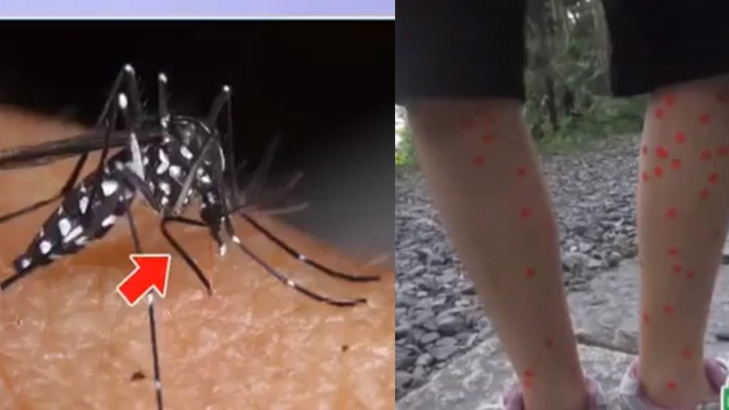 哪種人最易被蚊咬？