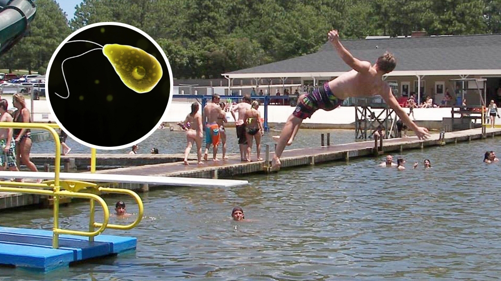 美國男子去水上樂園遊玩嗆水感染食腦蟲