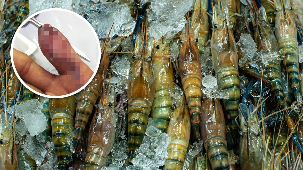 新加坡男洗蝦意外割傷惹食肉菌