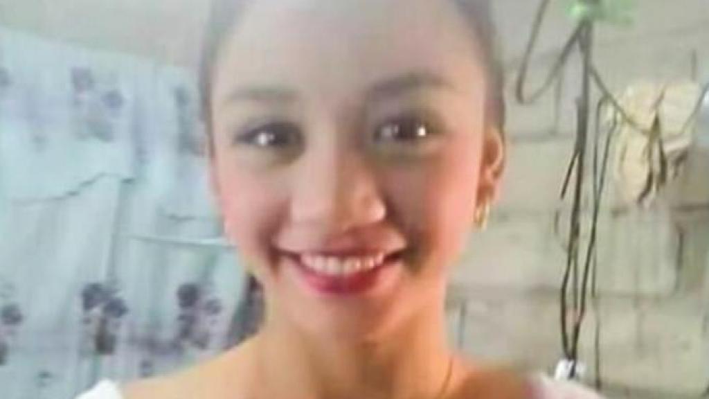菲律賓17歲少女手擠黑頭變毀容