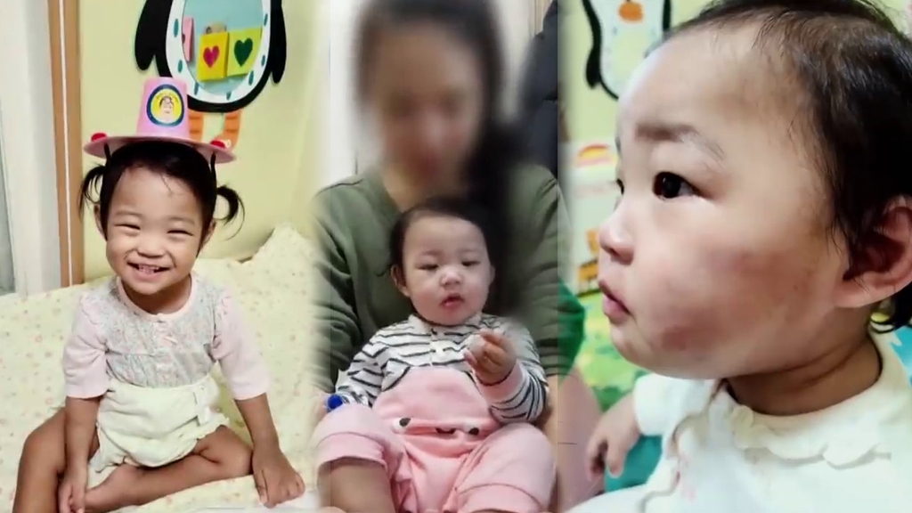 韓國1歲養女遭養父母虐待致死引民憤