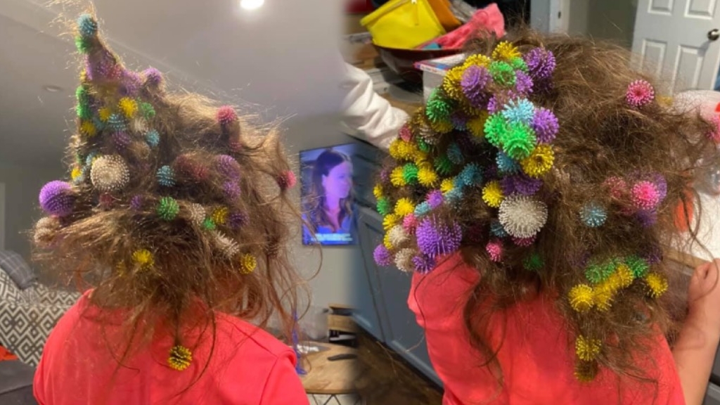 美國6歲女孩頭髮意外纏滿150個黏貼球