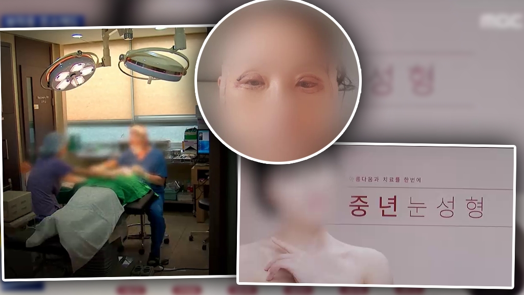 韓55歲婦為求職整容現嚴重後遺症