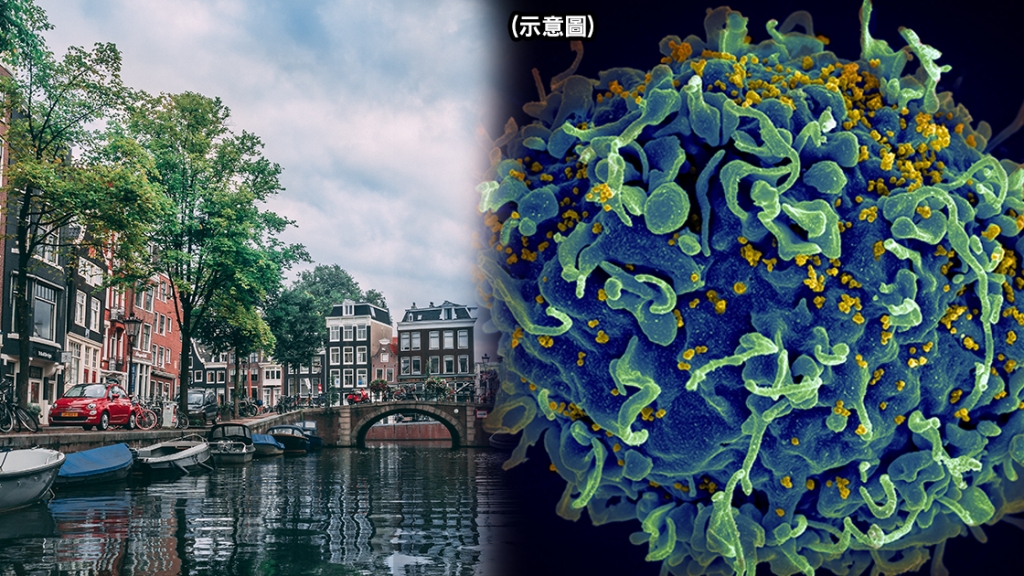 荷蘭發現突變HIV病毒株
