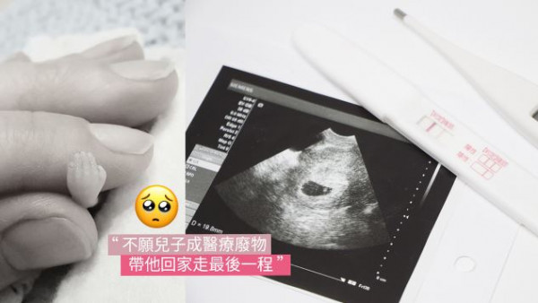 40歲媽媽誕14周流產死胎！緊握「小手」道別感動網民！不願淪爲醫療廢物帶回家安葬！