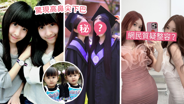 「最美雙胞胎」Sandy&Mandy大學畢業！21歲逆天顏值惹熱議！被指與兒時差距大？